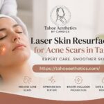 laserskinresurfacing