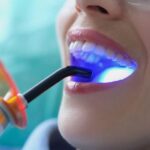 teethwhitening