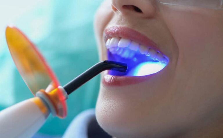 teethwhitening