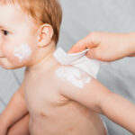 cream for baby eczema