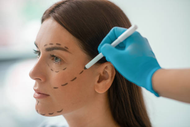 Are Facelifts Worth Considering for Loose Facial Skin