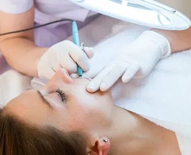 Can Electrolysis treat unwanted upper lip hair safely