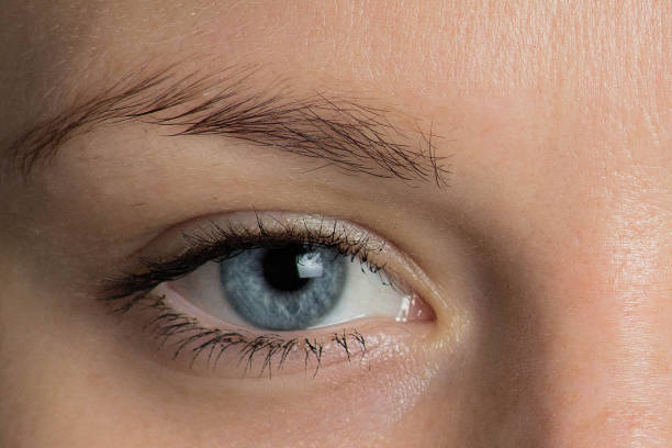 Can Eyelid Surgery Address Excess Eyelid Skin and Folds