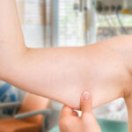 Can Fat Melting Injections reduce arm fat