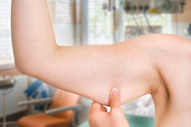 Can Fat Melting Injections reduce arm fat