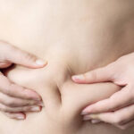 Can Fat Reduction improve overall body contours