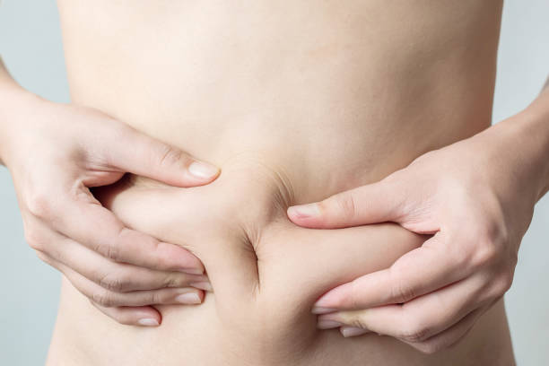 Can Fat Reduction improve overall body contours