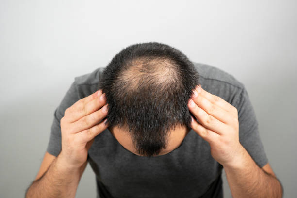 Can GFC Treatment for Hair Improve Scalp Health