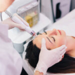 Can HydraFacial reduce stubborn blackheads safely