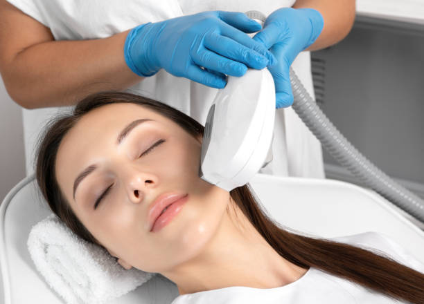 Can Laser Hair Removal Treat Chin Hair in Women