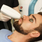 Can Men’s Laser Hair Removal shape the beard line