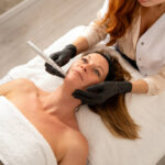 Can Microneedling Treat Stretch Marks Effectively