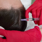 Can PRP Hair Treatment restore healthy hair growth