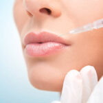 Can Russian Lip Fillers Improve Uneven Lip Symmetry