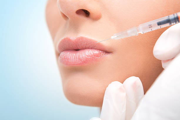 Can Russian Lip Fillers Improve Uneven Lip Symmetry