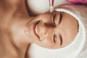 Does Dermapen Treatment Brighten Dull Skin