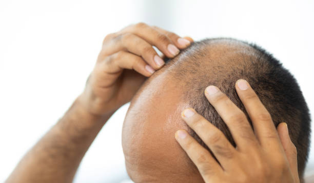 Does GFC Treatment for Hair require any downtime