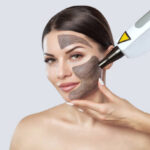 Does Laser Carbon Peel Brighten Tired-Looking Skin