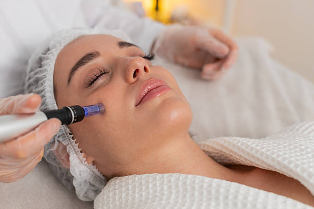 How Can Microneedling Improve Uneven Skin Tone Safely
