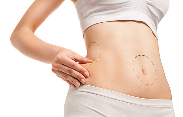 How safe is Lipo Abdominoplasty for body contouring