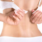 Is Bra Line Lift suitable for stubborn skin laxity