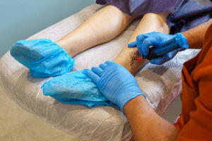Is Laser Tattoo Removal permanent