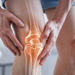 Osteomyelitis