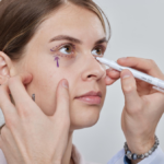 Polynucleotides Under Eyes in Manchester