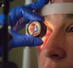 Cataract Surgery Cost in Delhi Complete Guide