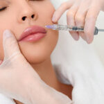 What Should You Expect from Lip Fillers Injection