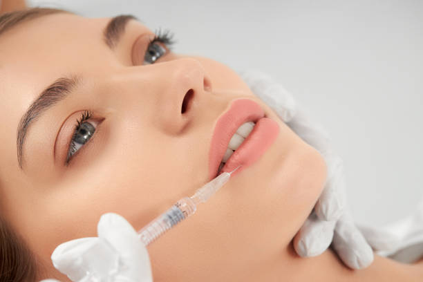Are Russian Lip Fillers suitable for mature lips