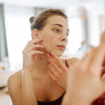 Can Acne Treatment Improve Acne-Prone Skin Over Time