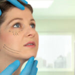 Can Facelifts offer long-lasting anti-aging results