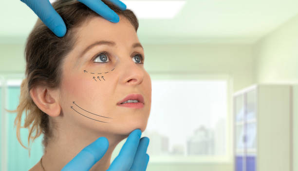 Can Facelifts offer long-lasting anti-aging results