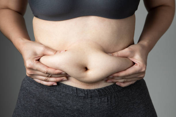 Can Fat Reduction improve your overall body shape