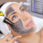 Can Laser Carbon Peel Improve Uneven Skin Texture