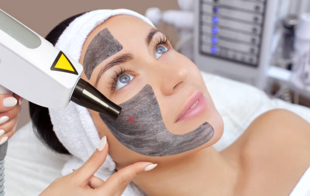 Can Laser Carbon Peel Improve Uneven Skin Texture