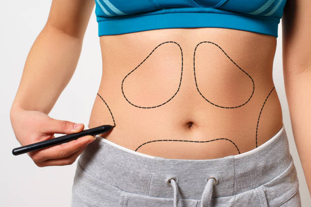 Can Mini Tummy Tuck Tighten Lower Belly Skin