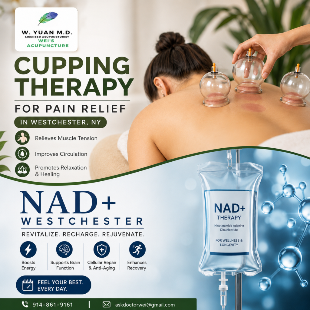Cupping Therapy for Pain Relief in Westchester in NY