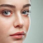 Do Under Eye Fillers improve facial freshness naturally