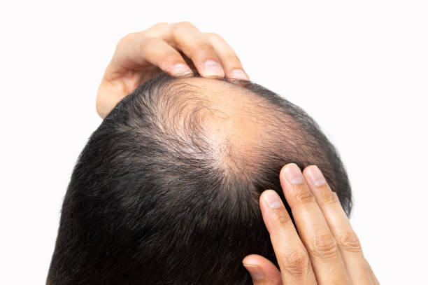 Does G Cell Treatment improve hair volume over time