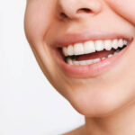 Does Teeth Whitening change your natural tooth color