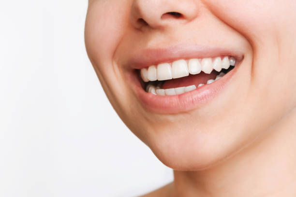Does Teeth Whitening change your natural tooth color