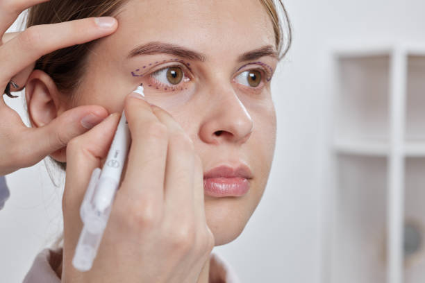 Is Blepharoplasty suitable for younger adults too