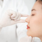 Is Rhinoplasty Effective for Nose Asymmetry
