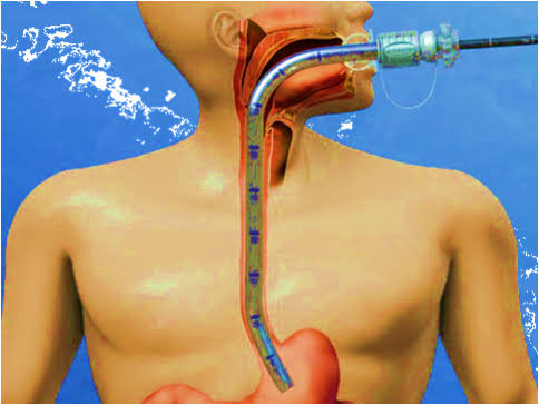painless endoscopy hospital in guwahati
