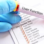 livertest