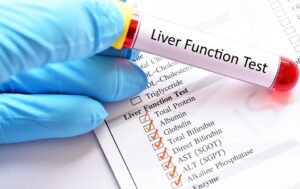 livertest