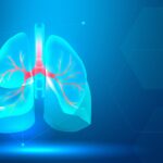 lung-scanning