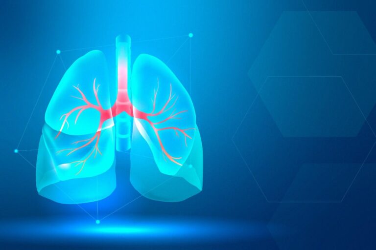 lung-scanning